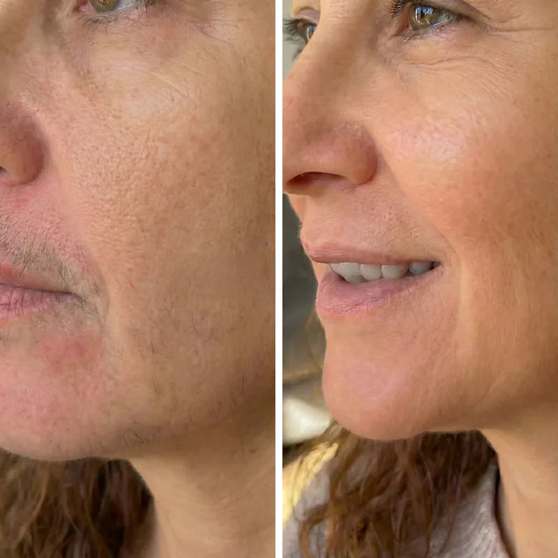 Maja Skin™ | Hårvæksthæmmende serum