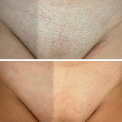 Maja Skin™ | Hårvæksthæmmende serum