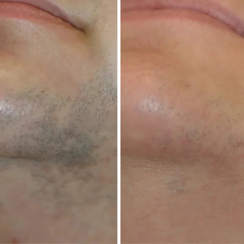 Maja Skin™ | Hårvæksthæmmende serum