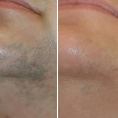 Maja Skin™ | Hårvæksthæmmende serum